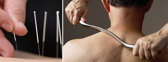 acupuncture needles physical manipulation treatment techniques